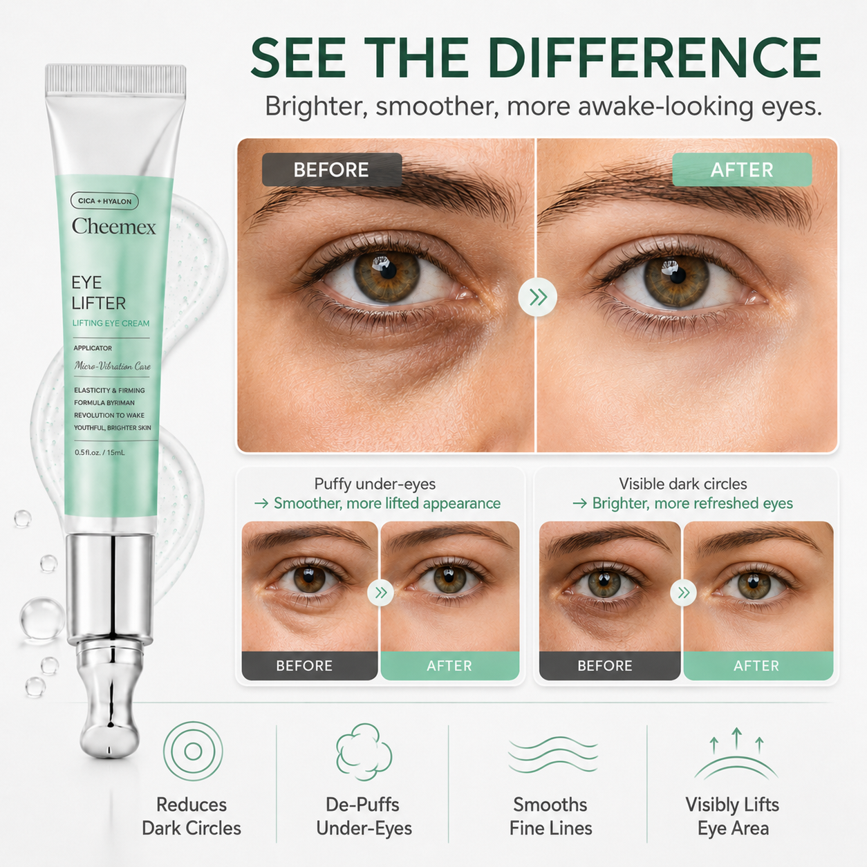 🔥Buy 1 Get 1 Free✨Cheemex PDRN Micro-Vibration Eye Cream