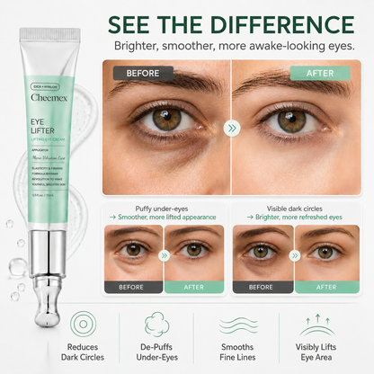 🔥Buy 1 Get 1 Free✨Cheemex PDRN Micro-Vibration Eye Cream