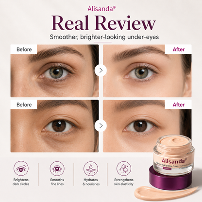 Korean Cosmetics✨Calcium Dark Spot Eye Cream | Dark Circle, Anti-aging, Sagging, Elasticity |