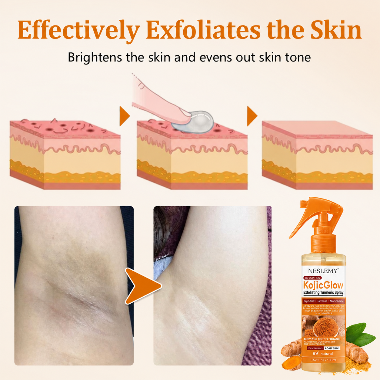 Last Day⏰Buy 1 Get 1 Free🔥NESLEMY® KojicGlow Exfoliating Turmeric Spray