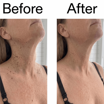 Buy 1 Get 1 Free🔥Smooth & Even Glycolic Body Stick