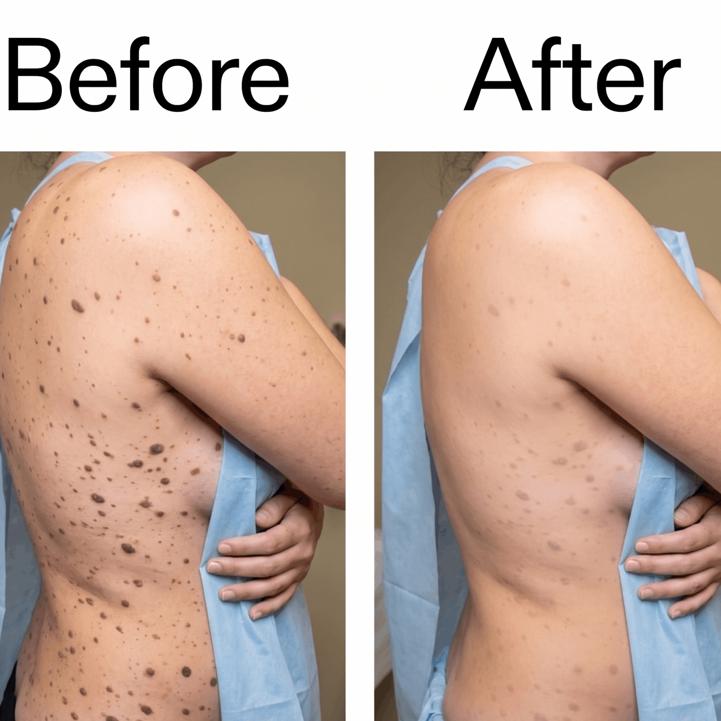 Buy 1 Get 1 Free🔥Smooth & Even Glycolic Body Stick